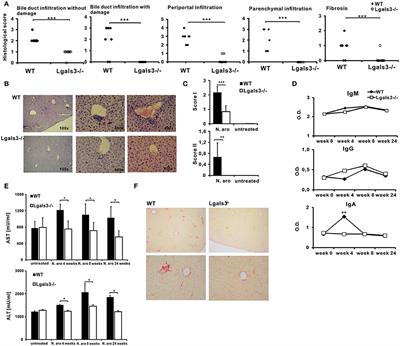 Gal-3 Deficiency Suppresses Novosphyngobium aromaticivorans Inflammasome Activation and IL-17 Driven Autoimmune Cholangitis in Mice